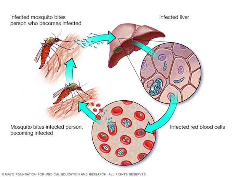 Do you know about Malaria  infectious disease?